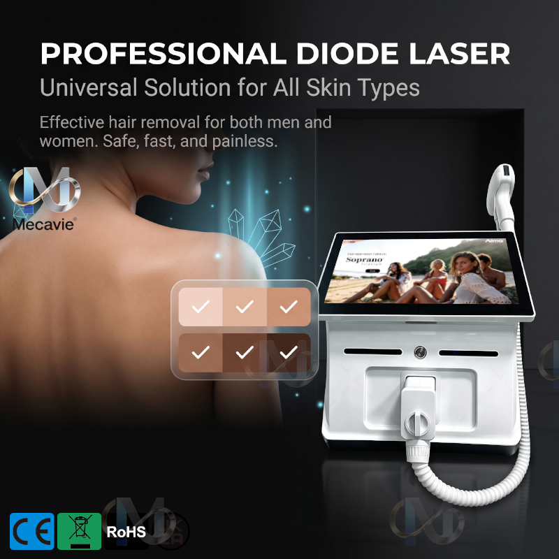 소프라노 2026 최고의 제모 레이저 블랙 아이스 플래 - Industrial Laser Hair Removal Machine 리뷰 및 가격